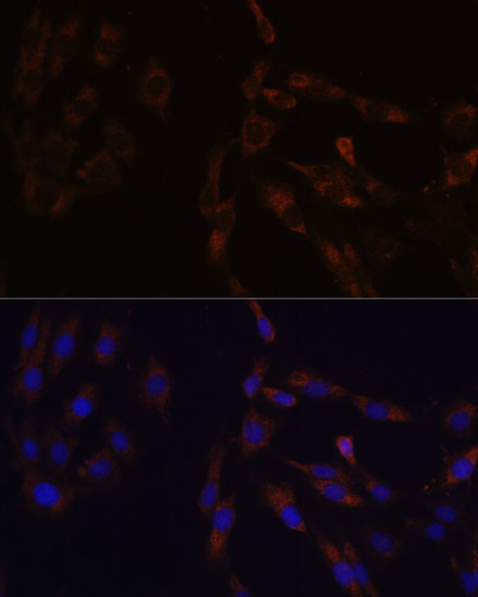 Anti-SUCLG2 Polyclonal Antibody (CAB8976)