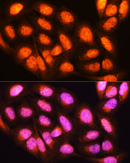 Anti-YWHAE Antibody (CAB1058)