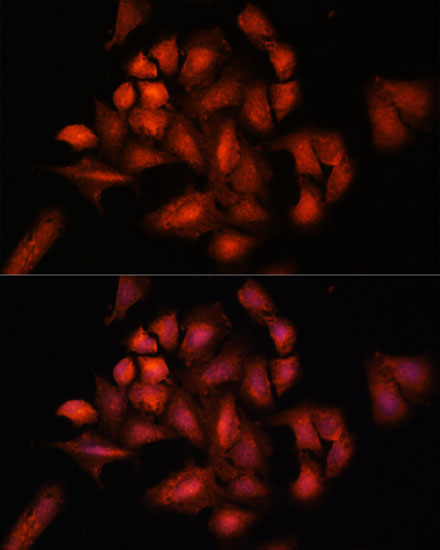 Anti-STAM2 Antibody (CAB7058)