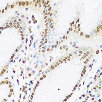 Anti-XRCC5 Antibody (CAB13369)