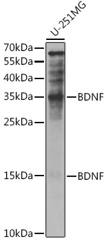 Anti-BDNF Antibody (CAB11028)