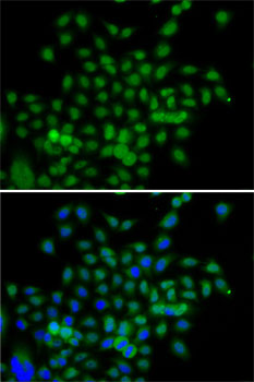 Anti-BCAS3 Antibody (CAB7274)