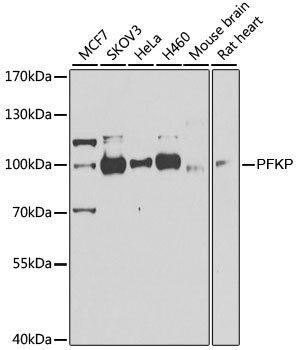 Anti-PFKP Antibody [KO Validated] (CAB7916)