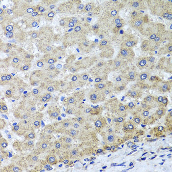 Anti-OSGEPL1 Polyclonal Antibody (CAB8022)