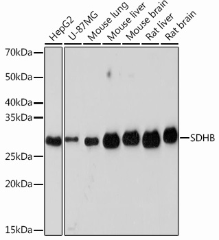 Anti-SDHB Rabbit Monoclonal Antibody (CAB1809)