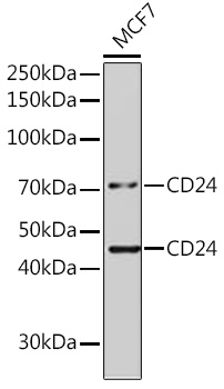 Anti-CD24 Antibody (CAB17444)