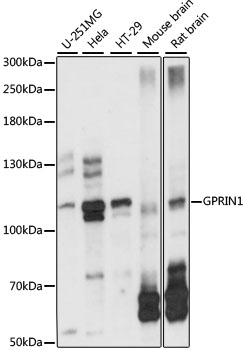 Anti-GPRIN1 Antibody (CAB15555)