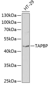 Anti-TAPBP Antibody (CAB1968)