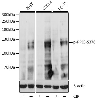 Anti-Phospho-PPIG-S376 pAb (CABP0842)