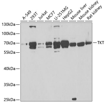 Anti-TKT Antibody (CAB6314)