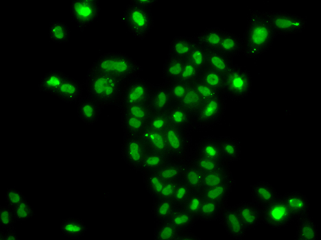 Anti-MORF4L2 Antibody (CAB7577)