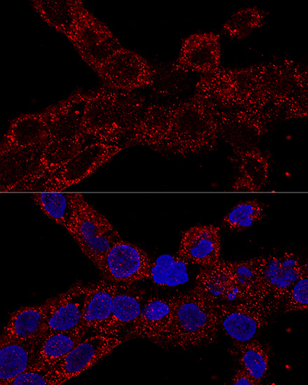 Anti-RPL21 Antibody (CAB14254)