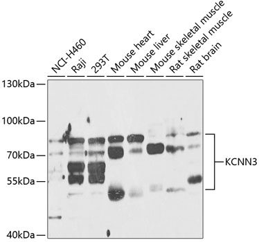 Anti-KCNN3 Antibody (CAB14012)