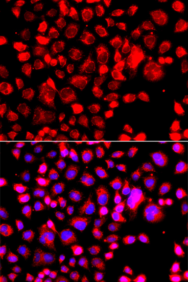 Anti-CCL11 Antibody (CAB7569)