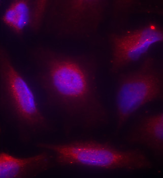 Anti-Phospho-NTRK1-S791 Antibody (CABP0272)