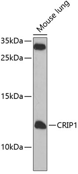 Anti-CRIP1 Antibody (CAB7548)