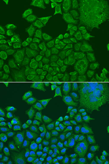 Anti-FXR1 Antibody (CAB5942)