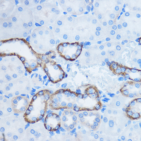 Anti-YWHAZ Antibody (CAB7639)