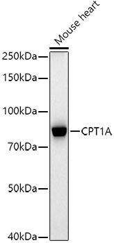 Western blot analysis of extracts of Mouse heart, using CPT1A antibody at 1:1000 dilution. Secondary antibody: HRP Goat Anti-Rabbit IgG (H+L) at 1:10000 dilution. Lysates/proteins: 25ug per lane. Blocking buffer: 3% nonfat dry milk in TBST. Detection: ECL Basic Kit. Exposure time: 180s.