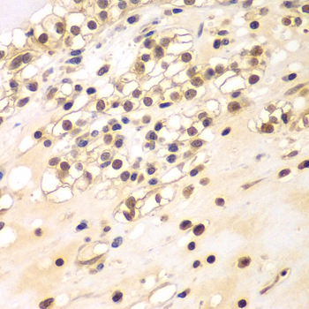 Anti-BCAS3 Antibody (CAB7274)