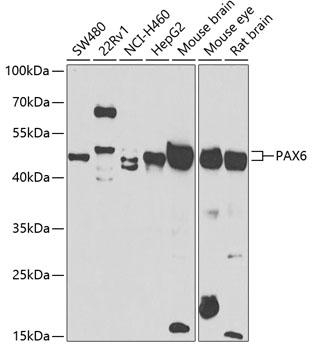 Anti-PAX6 Antibody (CAB7334)