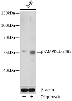 Anti-Phospho-PRKAA1-S485 pAb (CABP0871)