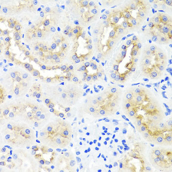 Anti-ATP7A Polyclonal Antibody (CAB8399)