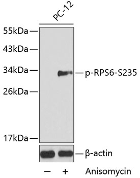 Anti-Phospho-RPS6-S235 Antibody (CABP0227)