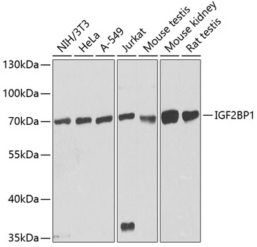 Anti-IGF2BP1 Antibody (CAB1517)