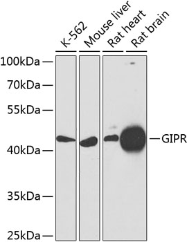 Anti-GIPR Polyclonal Antibody (CAB9816)