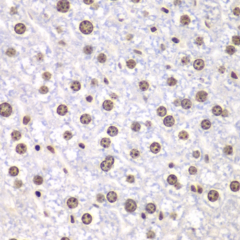 Anti-TOP1 Antibody (CAB12524)