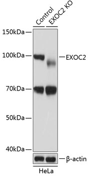 Anti-EXOC2 Antibody [KO Validated] (CAB19948)