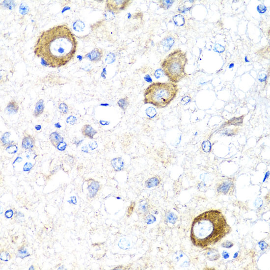 Anti-NRG4 Antibody (CAB2599)