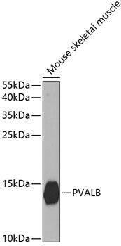 Anti-PVALB Antibody (CAB2791)