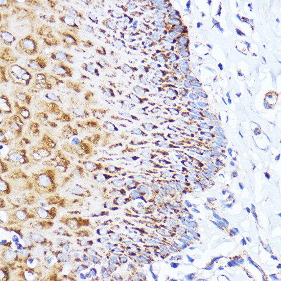 Anti-IL-11 Antibody (CAB1902)