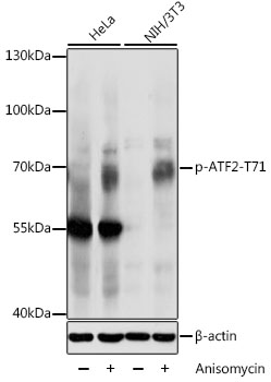 Anti-Phospho-ATF2-T71 Antibody (CABP0020)