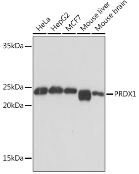 Anti-PRDX1 Antibody (CAB4956)