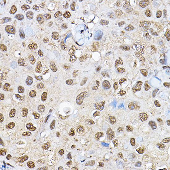 Anti-p70 S6 kinase Antibody (CAB16658)