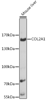 Anti-COL2A1 Antibody (CAB1560)