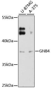 Anti-GNB4 Antibody (CAB12731)