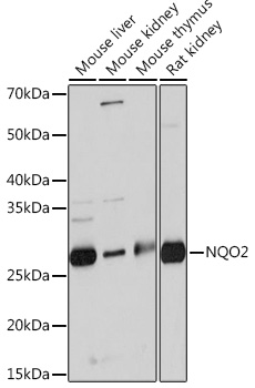 Anti-NQO2 Antibody (CAB3846)