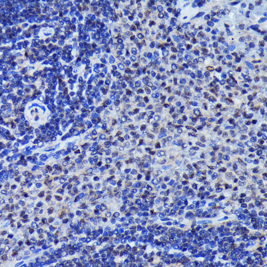 Anti-Phospho-JNK1/2/3-T183/T183/T221 mAb Antibody (CABP0631)