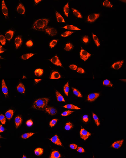 Anti-GCSH Antibody (CAB13695)