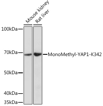 Anti-MonoMethyl-YAP1-K342 Antibody (CAB18651)