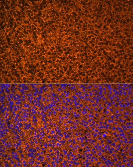 Anti-PTCH1 Antibody (CAB14772)