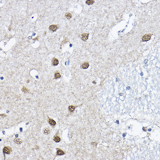 Anti-ORC6 Antibody (CAB5426)