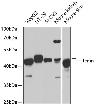 Anti-Renin Antibody (CAB1585)