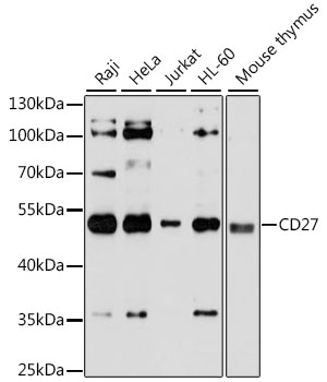 Anti-CD27 Antibody (CAB1945)