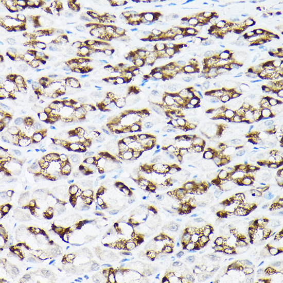 Anti-SLC8A1 Antibody (CAB5583)