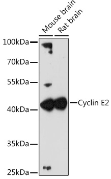 Anti-Cyclin E2 Antibody (CAB4272)